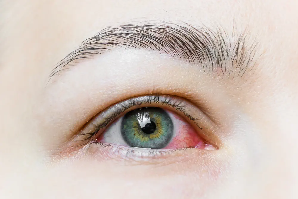 2 CCFA's Expert Guide on The Short-Term Effects of Cannabis