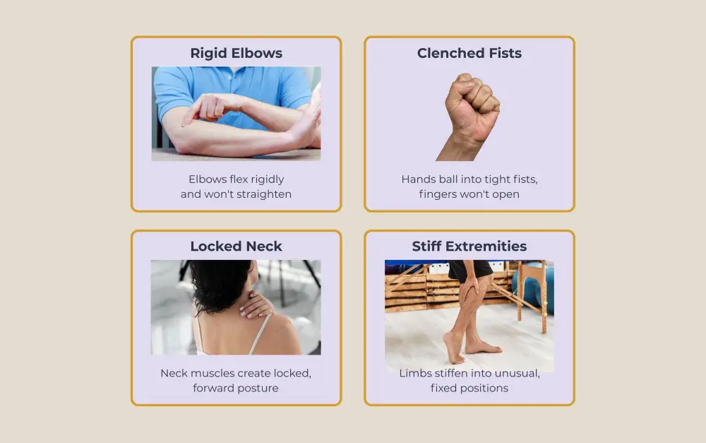 Four panels illustrating rigid elbows, clenched fists, locked neck, and stiff extremities.
